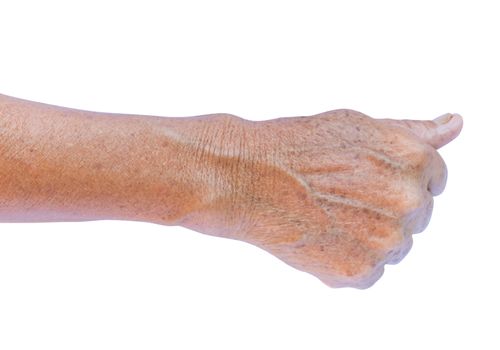 Old woman's arm with wrinkles on arm with white background, beauty care and health care concept