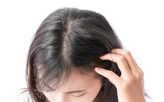 Closeup woman hand itchy scalp, Hair care concept