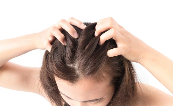 Closeup woman hand itchy scalp, Hair care concept