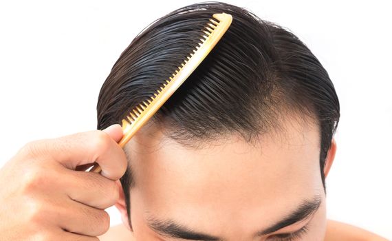 Young man worry hair loss problem for health care shampoo and beauty product concept