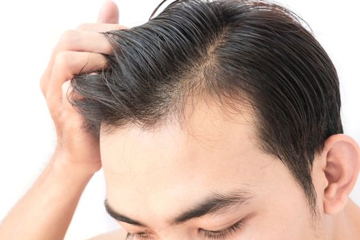 Young man worry hair loss problem for health care shampoo and beauty product concept