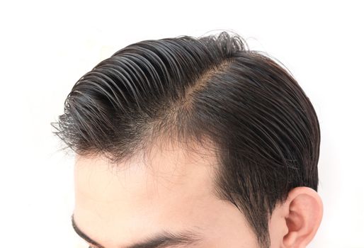 Young man worry hair loss problem for health care shampoo and beauty product concept