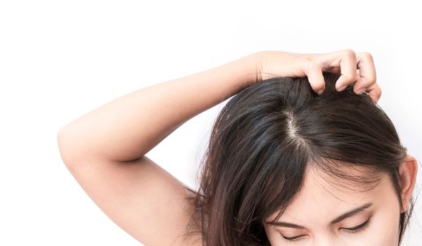 Closeup woman hand itchy scalp, Hair care concept