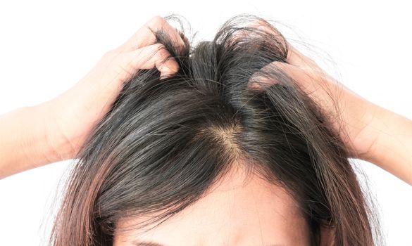 Closeup woman hand itchy scalp, Hair care concept