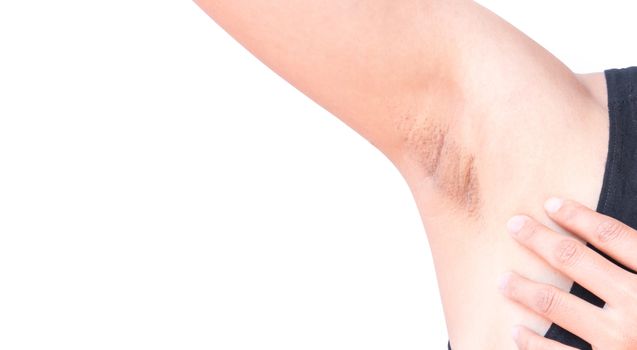 Women problem black armpit on white background for skin care and beauty concept