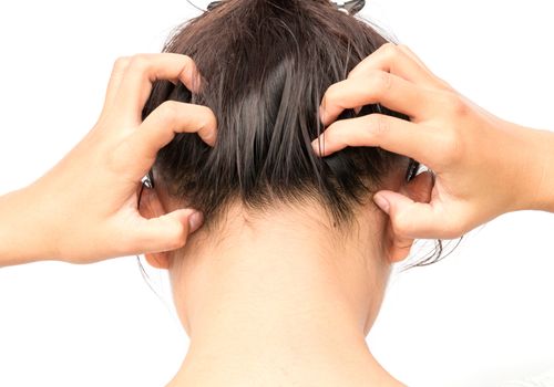 Closeup woman hand itchy scalp, Hair care concept