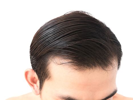 Young man worry hair loss problem for health care shampoo and beauty product concept