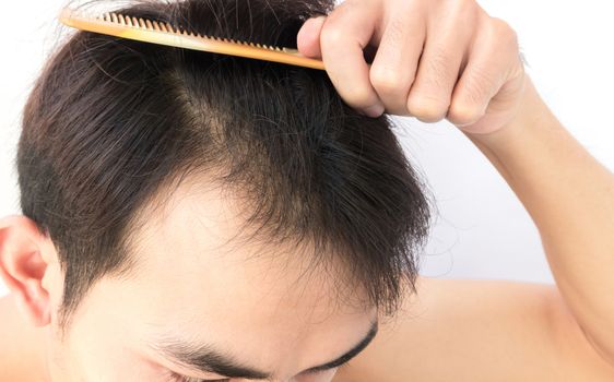 Young man worry hair loss problem for health care shampoo and beauty product concept