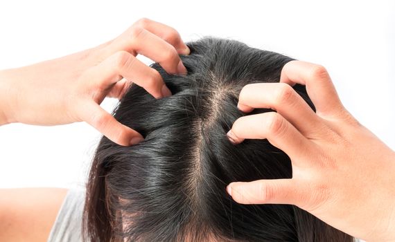 Closeup woman hand itchy scalp, Hair care concept