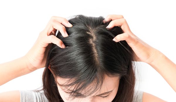 Closeup woman hand itchy scalp, Hair care concept