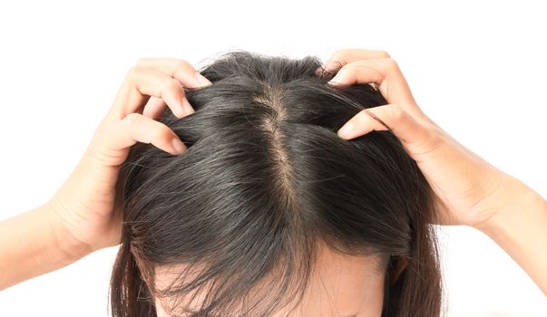 Closeup woman hand itchy scalp, Hair care concept