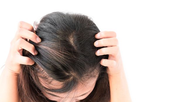 Closeup woman hand itchy scalp, Hair care concept