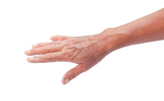 Wrinkled on old woman hand skin, healthy and beauty concept