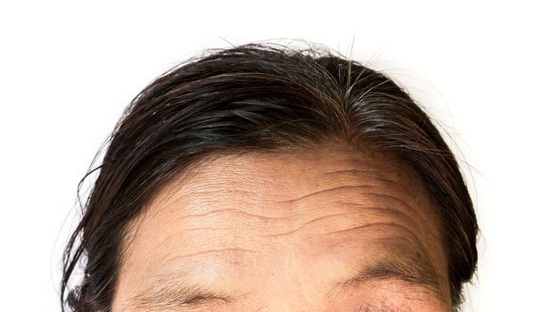 Closeup wrinkles on forehead old woman