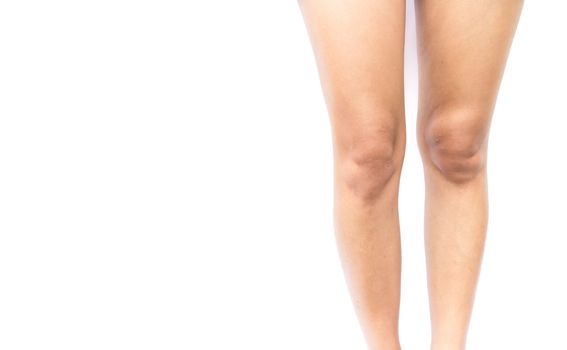 Problem dark skin on the thigh for Skin care and beauty concept