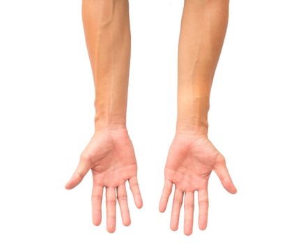 Man arm with blood veins on white background, health care and medical concept