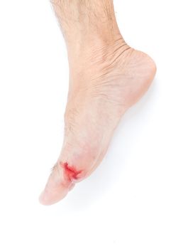Injured foot, Fresh wound and blood from broken glass, white background