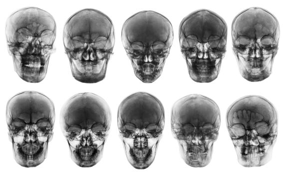 Collection of asian skull . front view . isolated background .