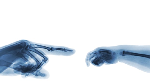 X-ray adult's hand point finger at left side and baby's hand at right side. Blank area at upper side .