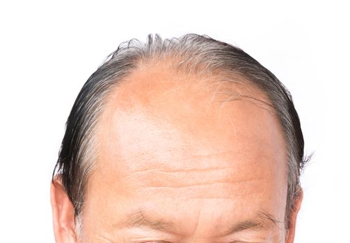 Closeup old man serious hair loss problem and gray for health care shampoo and beauty product concept