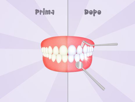 before and after cleaning the teeth