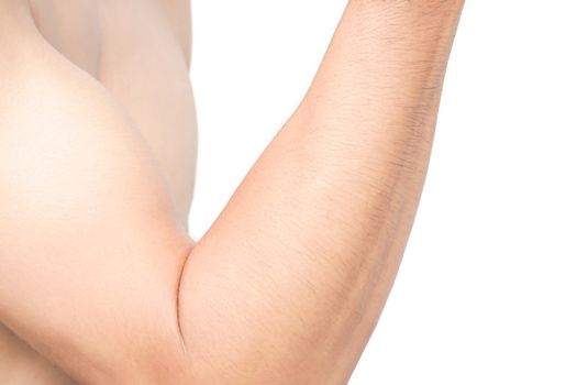 Man arm skin with white background, health care and medical concept