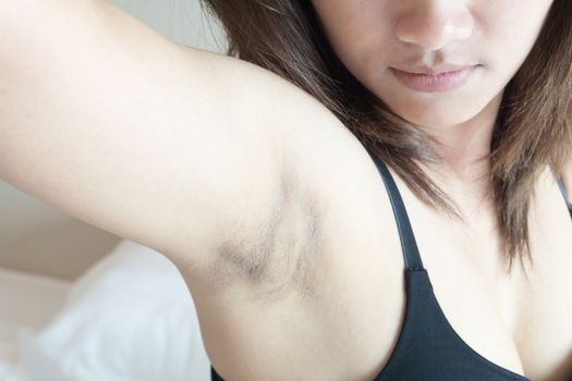 Closeup women problem black armpit with bedroom background for skin care and beauty concept