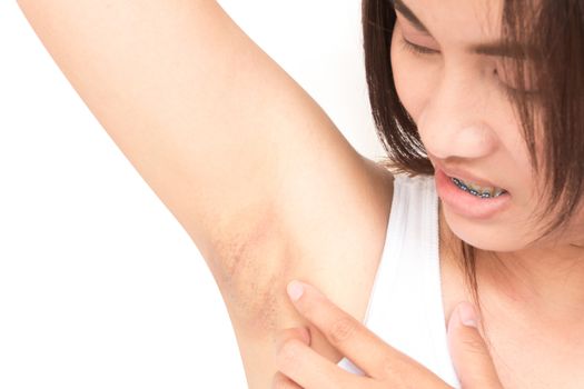 Women problem black armpit on white background for skin care and beauty concept