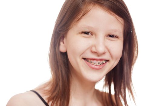 Laughing teen girl wearing braces looking at camera isolated on white