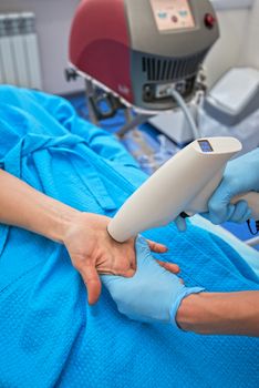 Procedure for palm against hyperhidrosis