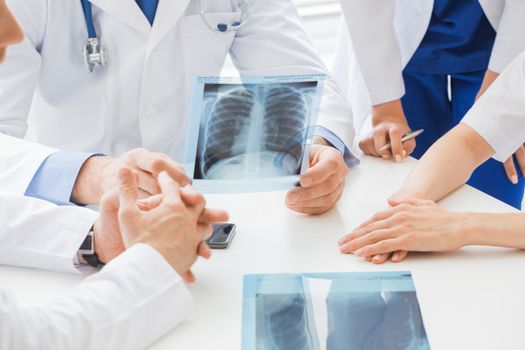 Group of doctors look and discuss x-ray in a clinic or hospital