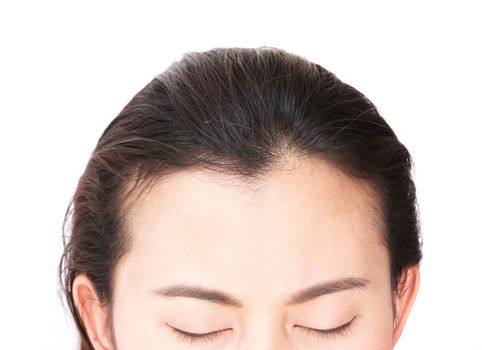 Woman serious hair loss problem for health care shampoo and beauty product concept