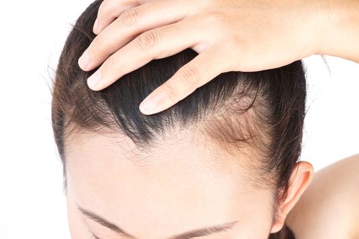 Woman serious hair loss problem for health care shampoo and beauty product concept