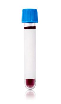 Blue vacuum blood tube test with sample blood for Medical laboratory isolated on white background, clipping path.