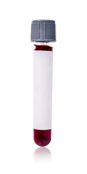 Grey vacuum blood tube test with sample blood for Medical laboratory isolated on white background, clipping path.