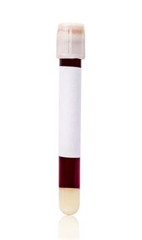 White vacuum blood tube test with sample blood for Medical laboratory isolated on white background, clipping path.