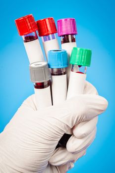 Hand holding Vacuum tubes for collecting blood samples in the laboratory.