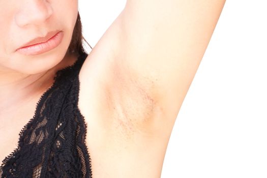 Women problem black armpit on white background for skin care and beauty concept