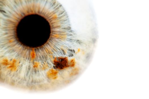 extreme close up of a human eye with reddish dots, shallow depth of field