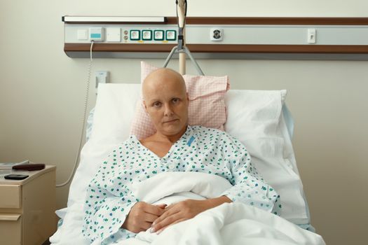 beautiful middle age woman patient with cancer in hospital on oncology department. She hope in healing. She lost her hair and have head without hair