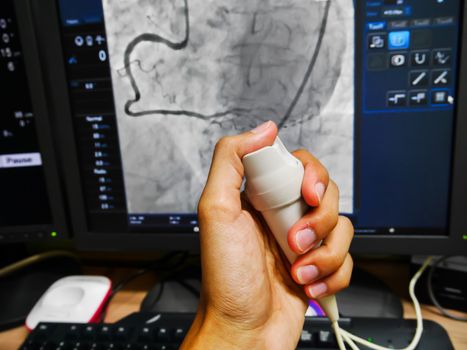 Hand switch x-ray in cardiac catheterization laboratory