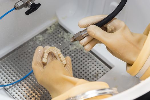 Dental Technician Cleans 3D Printed Dental Implant Bridge In Lab With Water.