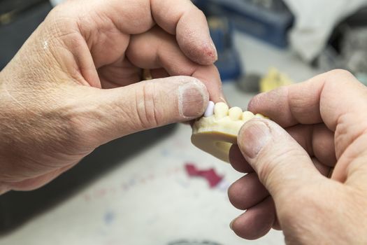 Male Dental Technician Working On A 3D Printed Mold For Tooth Implants In The Lab.