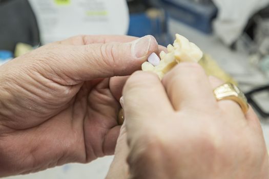 Male Dental Technician Working On A 3D Printed Mold For Tooth Implants In The Lab.