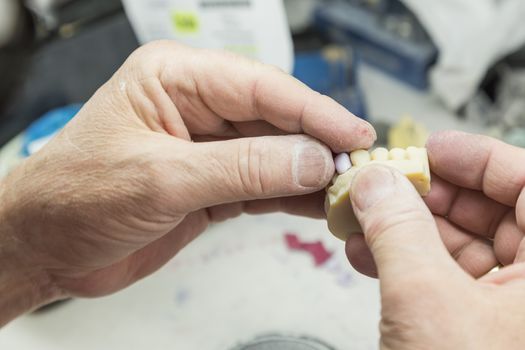 Male Dental Technician Working On A 3D Printed Mold For Tooth Implants In The Lab.