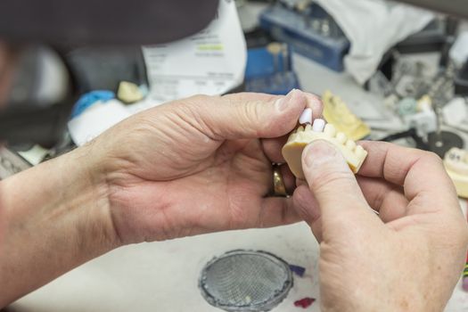 Male Dental Technician Working On A 3D Printed Mold For Tooth Implants In The Lab.