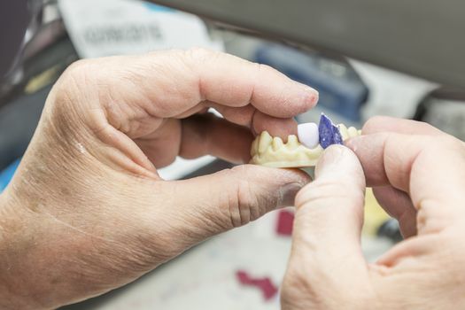 Male Dental Technician Working On A 3D Printed Mold For Tooth Implants In The Lab.