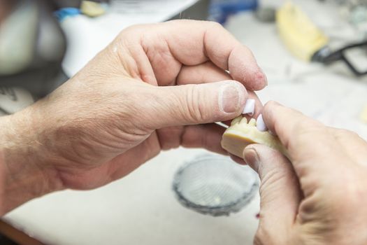 Male Dental Technician Working On A 3D Printed Mold For Tooth Implants In The Lab.