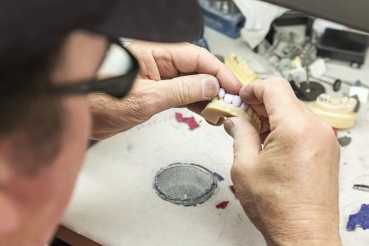 Male Dental Technician Working On A 3D Printed Mold For Tooth Implants In The Lab.