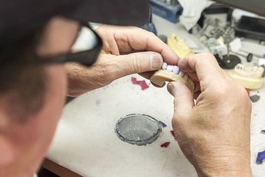 Male Dental Technician Working On A 3D Printed Mold For Tooth Implants In The Lab.